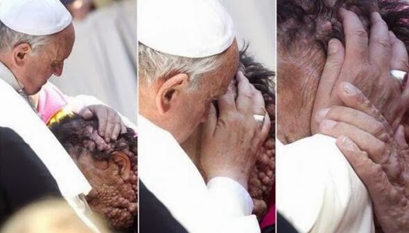 pope francis embraces